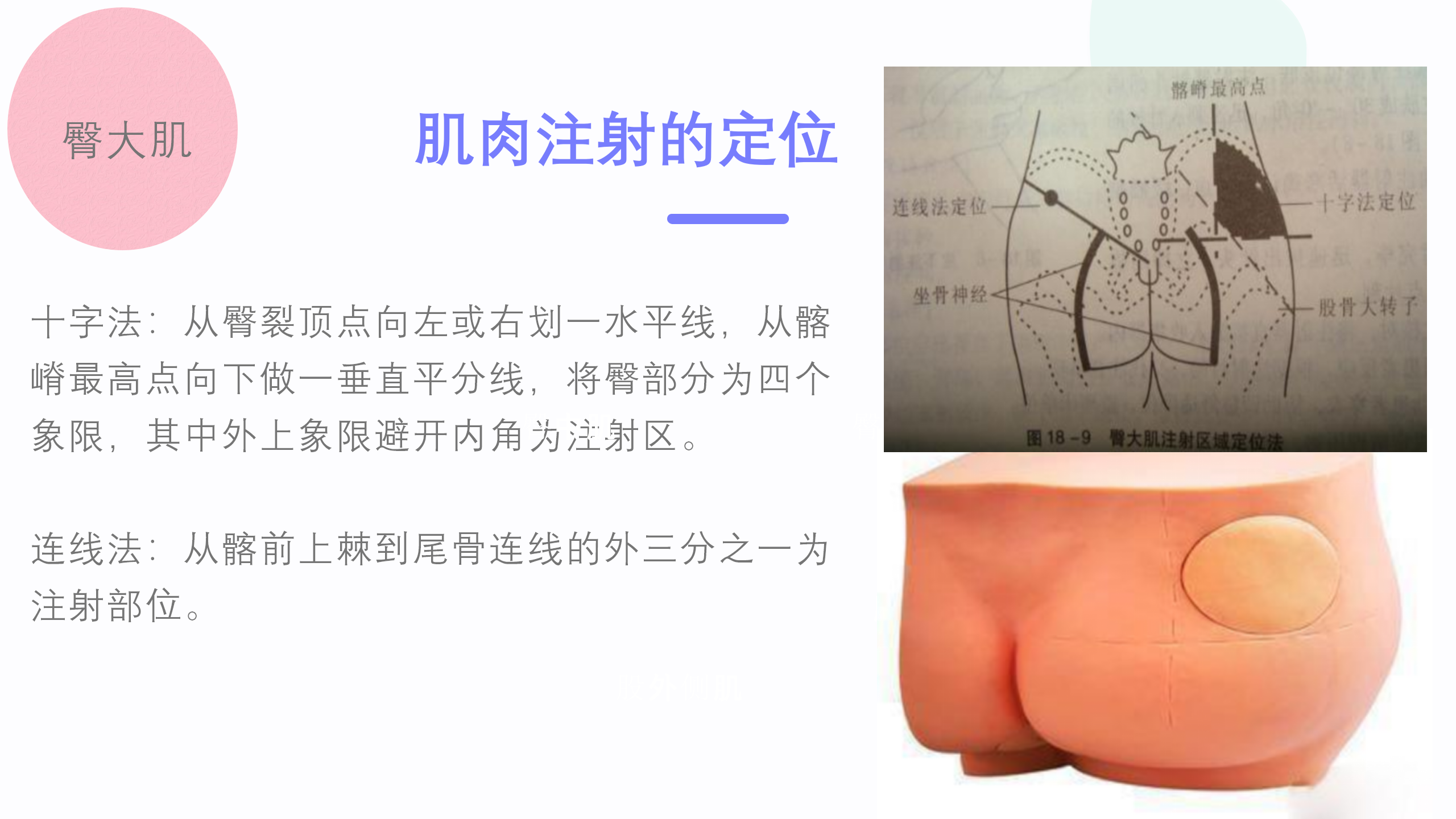 小儿肌肉注射部位及定位方法-沧州市眼科医院-赵红娟