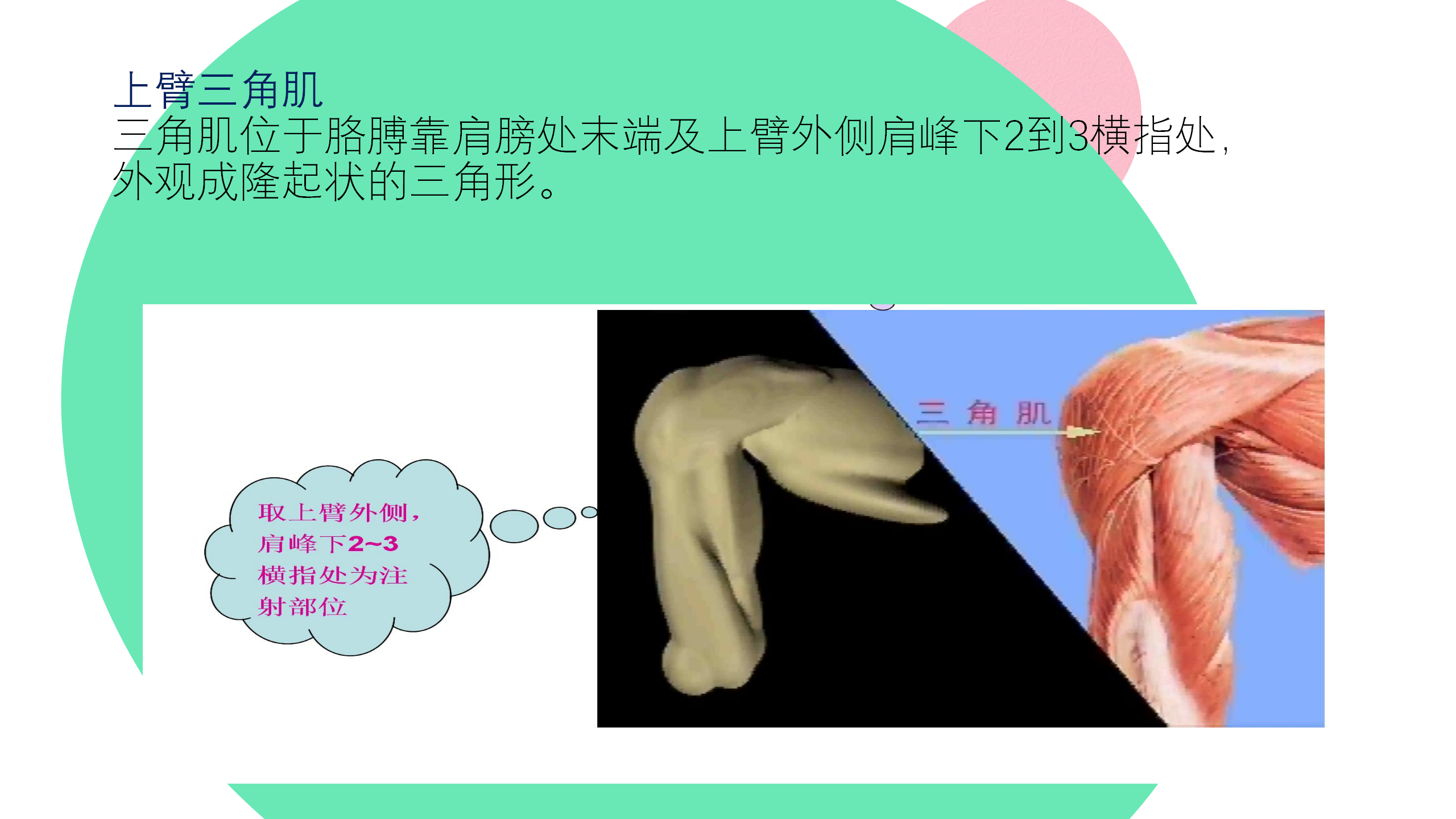 小儿肌肉注射部位及定位方法-沧州市眼科医院-赵红娟