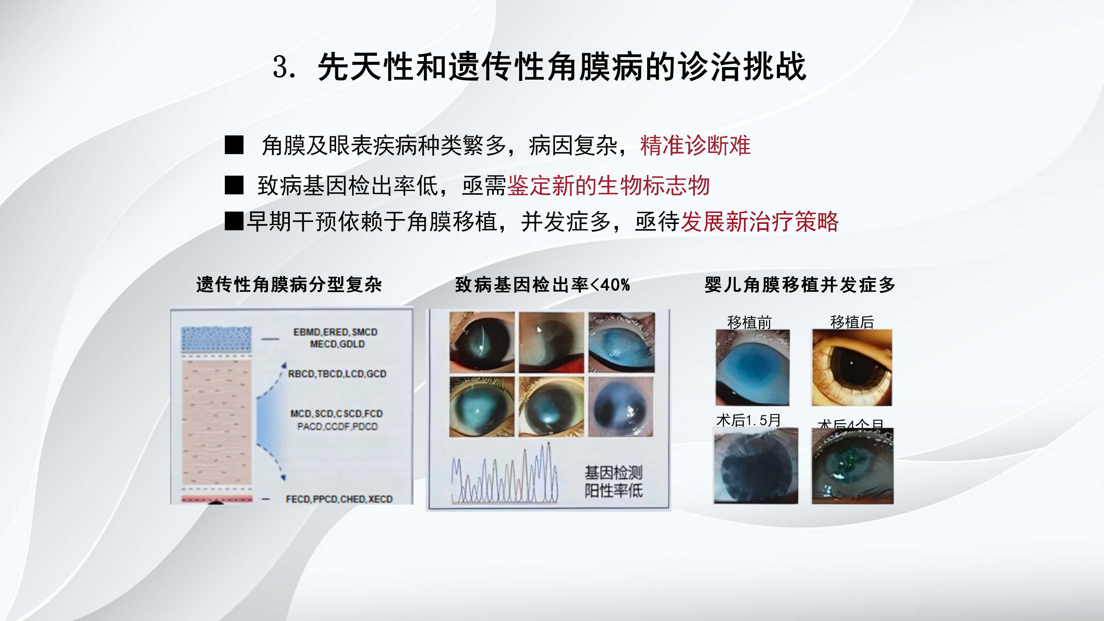 角膜病新进展-沧州市眼科医院-杨立东