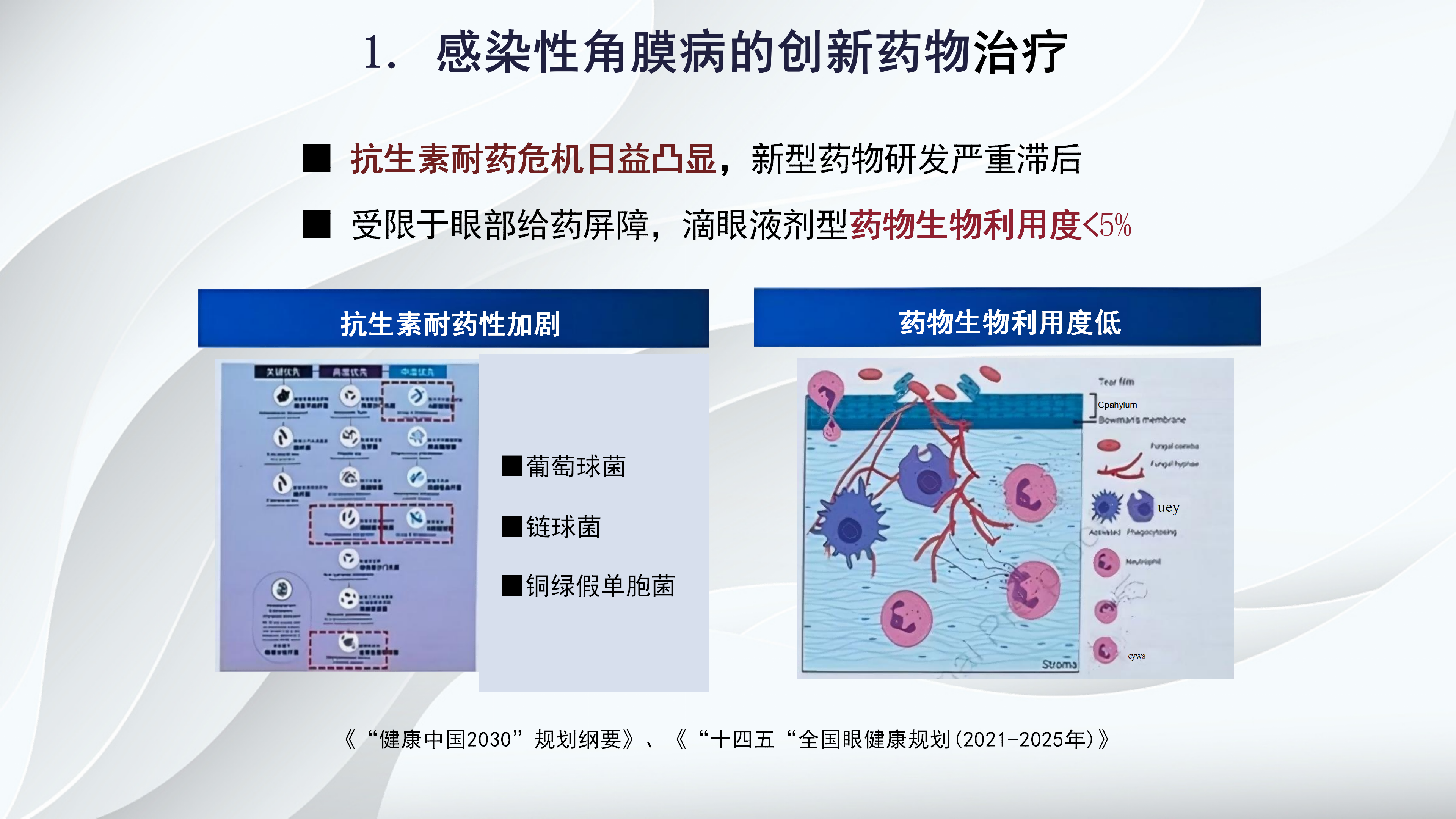 角膜病新进展-沧州市眼科医院-杨立东